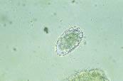 download horsehair worm eggs download horsehair worm eggs