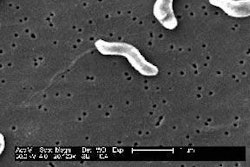 Food-borne bacteria: A scanning electron micrograph at 20 000x magnification showing a number of Gram-negative Campylobacter jejuni. (Photo by Dr P. Fields & Dr C. Fitzgerald, CDC, USA)