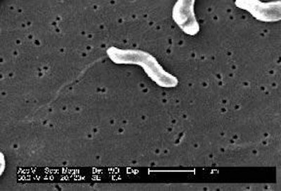 Food-borne bacteria: A scanning electron micrograph at 20 000x magnification showing a number of Gram-negative Campylobacter jejuni. (Photo by Dr P. Fields & Dr C. Fitzgerald, CDC, USA)
