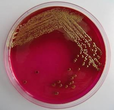 La cepa virulenta de la bacteria E. coli.
