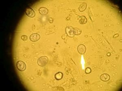 La E. tenella, aquí con 400x, es uno de los protozoarios que se puede asociar con la enteritis necrótica.