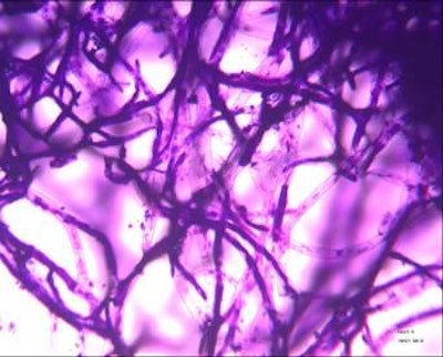 Foto cortesía de Biomax. | Imagen microscópica de las enzimas utilizadas en el proceso