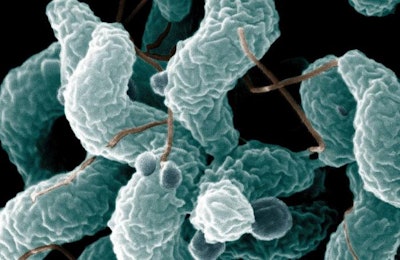 El Campylobacter es la causa más frecuente de gastroenteritis alimentaria en Europa occidental. | Wikimedia Commons, Departamento de Agricultura de los Estados Unidos (USDA)