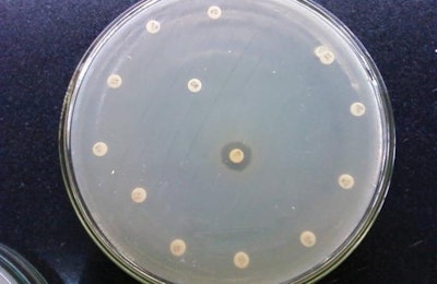 Antibiotic susceptibility test by disk diffusion shows resistance of this bacterial strain to all the tested antibiotics. | Wikimedia Commons | Microrao