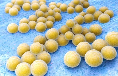 Methicillin-resistant Staphylococcus aureus (MRSA) is a bacterium responsible for several difficult-to-treat infections. | LexxIam