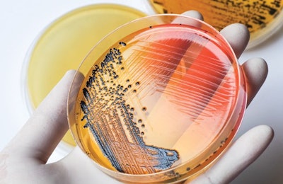 Culture-based methods usually only identify the most abundant serovars of Salmonella. A new method can detect less abundant ones too. (Chansom Pantip | iStock.com)